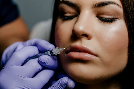 Cosmetic Surgery Lip Beauty photo