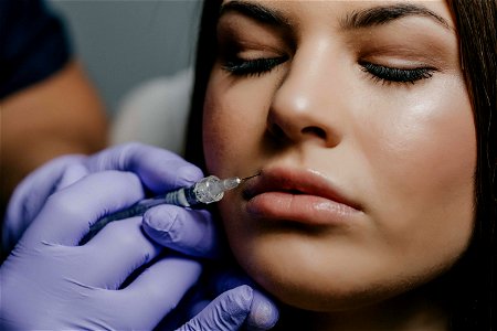 Cosmetic Surgery Lip Beauty