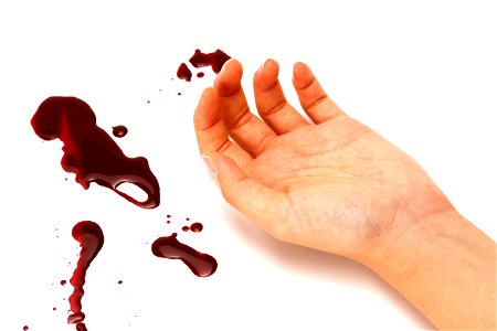 Hand Blood Murder photo