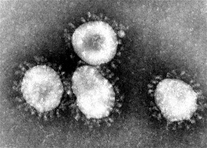 Novel Coronavirus photo