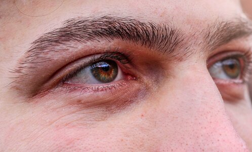 View iris pupil
