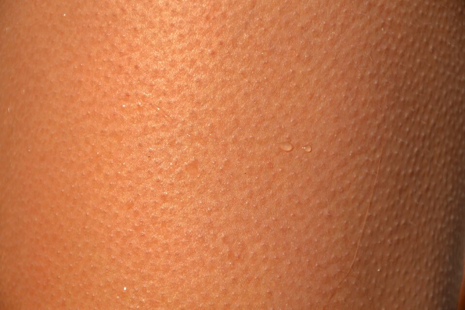Goosebumps goose skin cold