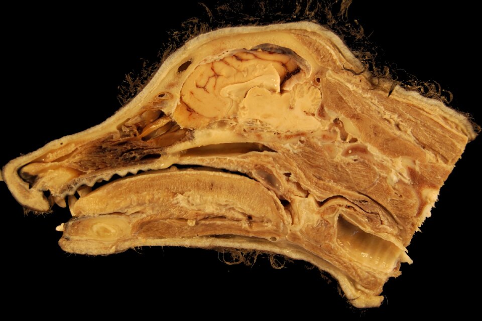 Sagittal section nasal cavity oral cavity