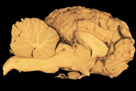 Anatomy preparation cerebellum