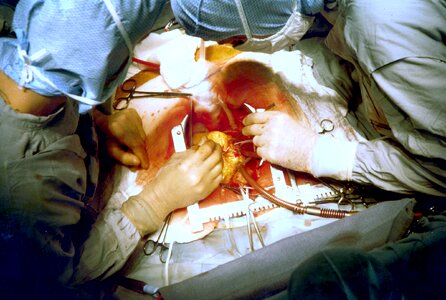 Heart medical surgeons photo