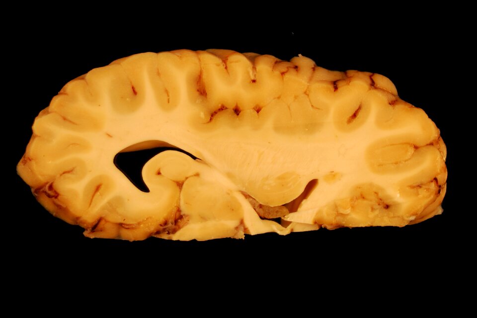Paerparat horse biology