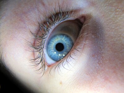 Watch eyelash skin