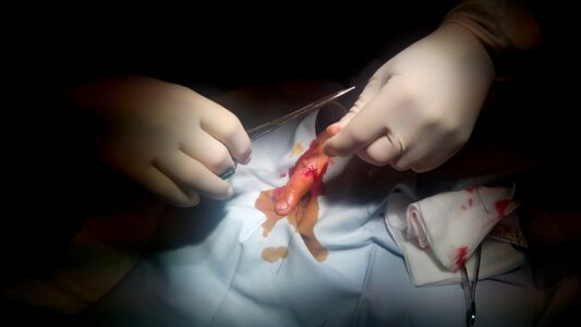 Hand medicine surgery