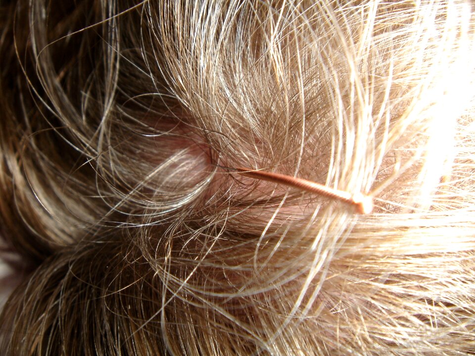 Needle head hair photo