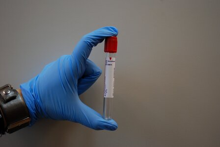 Diagnostics blood tube