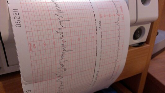 Evaluation pregnant pregnancy