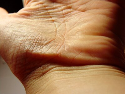Hand palm skin photo
