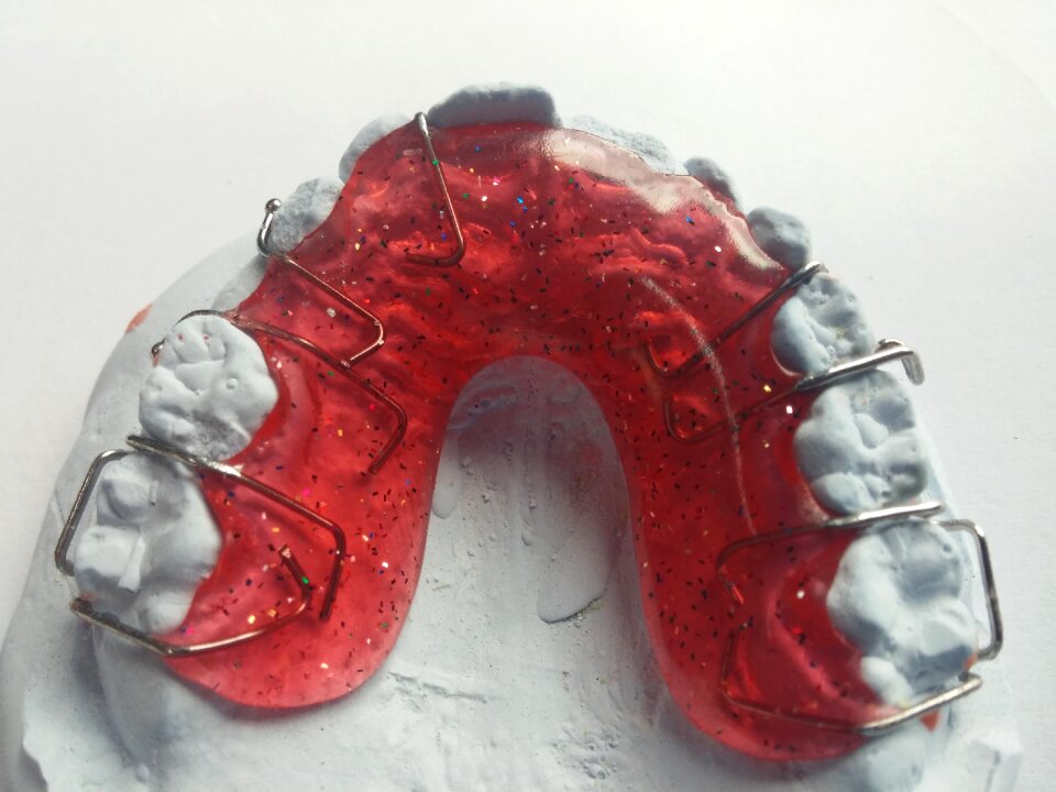 Rails dental braces tooth