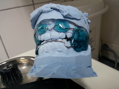Rails dental braces tooth photo