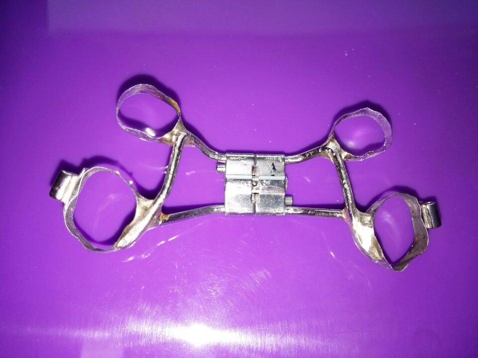 Dental rail rails dental braces
