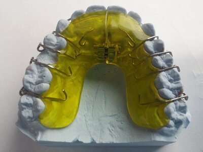 Dental rail rails tooth photo