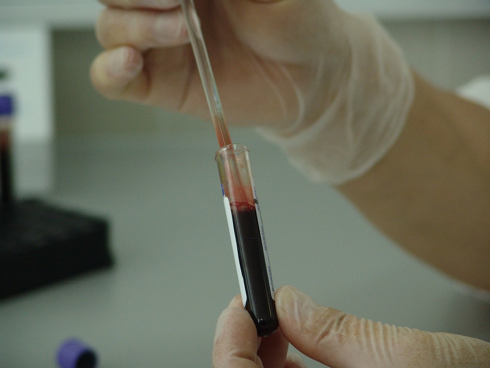 Laboratory test medical