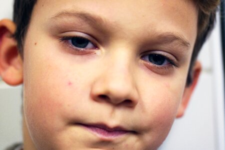 Eye toddler small child