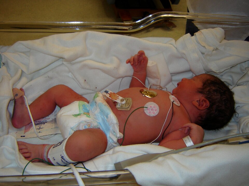 Boarding bebe intensive care newborn