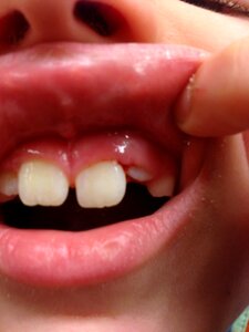 Teeth mouth dental photo