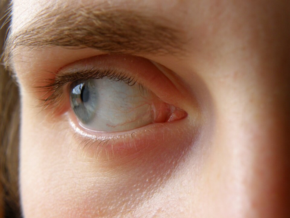 Iris algae eyebrows