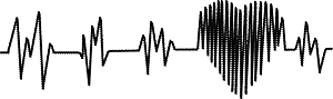 Electrocardiogram