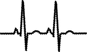 Electrocardiogram
