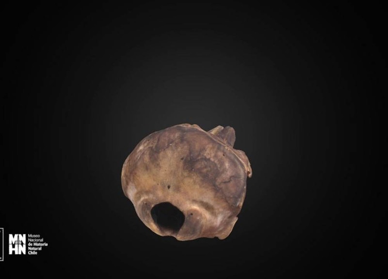 Thumb 6