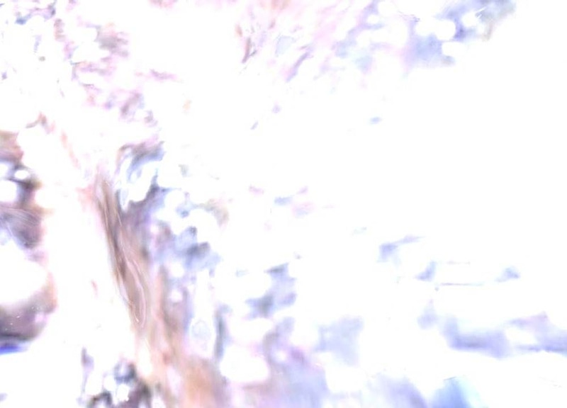 Thumb 7