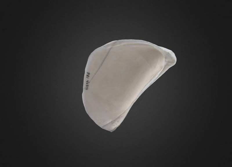 Thumb 9