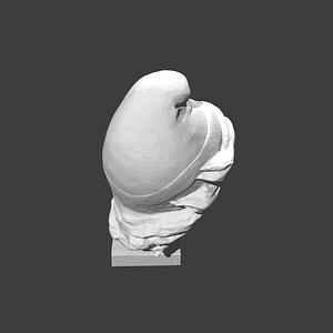 Thumb 9