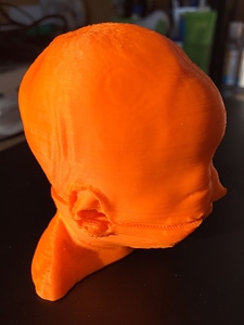 Cebocephaly