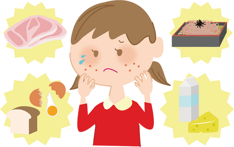 Allergy Allergic Diseases