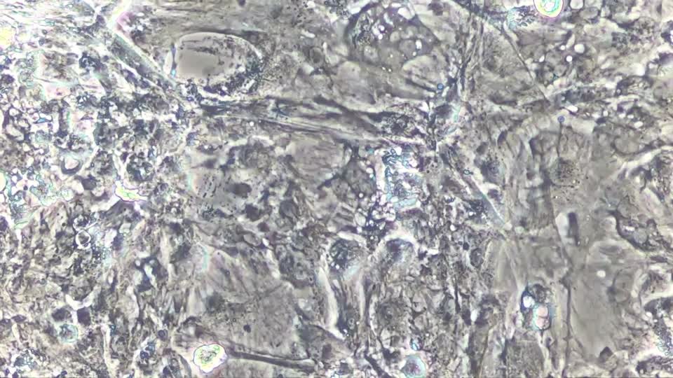 Cardiomyocytes contraction spontaneous