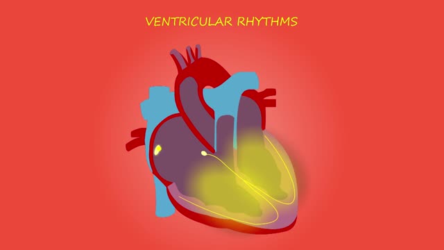 Cardiac arrhythmia narrated