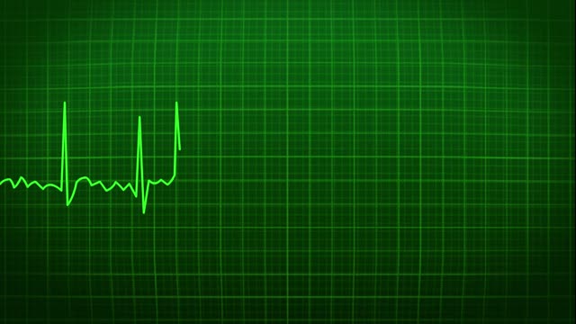 Ecg heartbeat heart