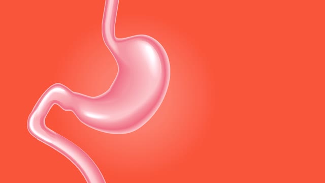 Stomach band surgery surgery obese