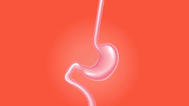 Stomach surgery medical body