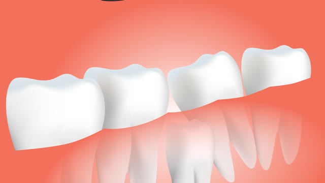 Dental surgery tooth