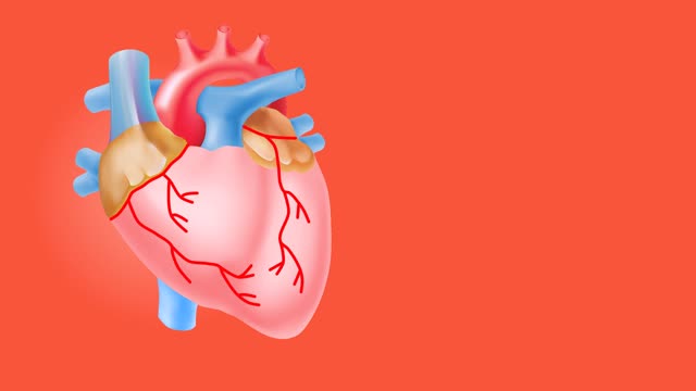 Heart attack coronary