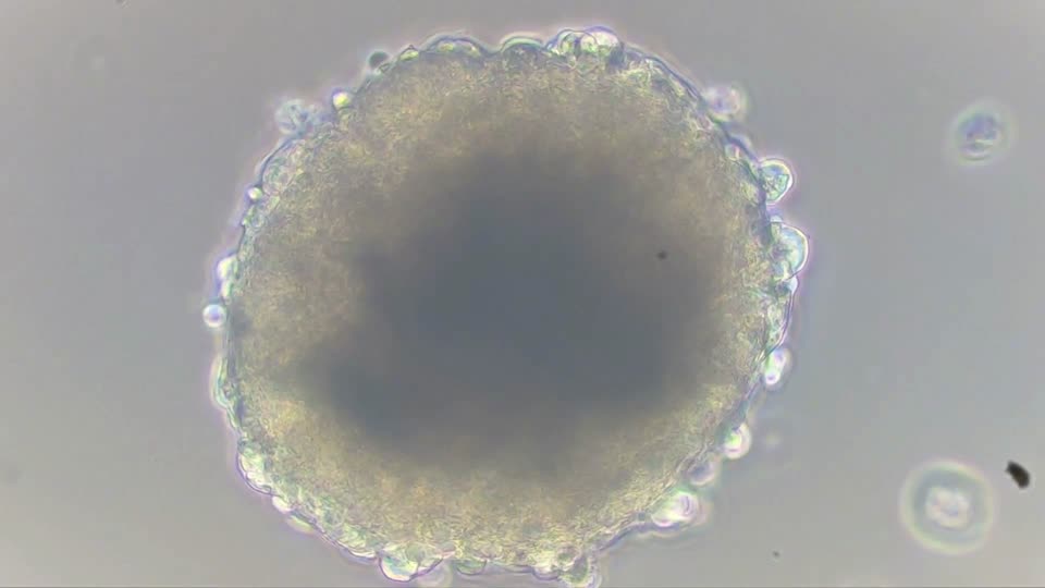 Cardiomyocytes heart cell culture