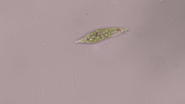 Flagellated Protozoa: Euglena