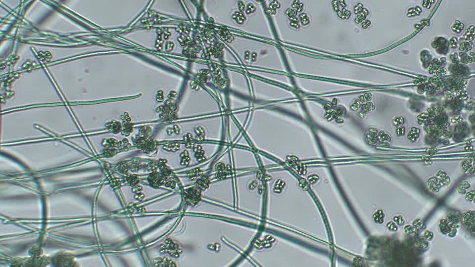 Video: The Cyanobacteria: Oscillatoria and Gleocapsa