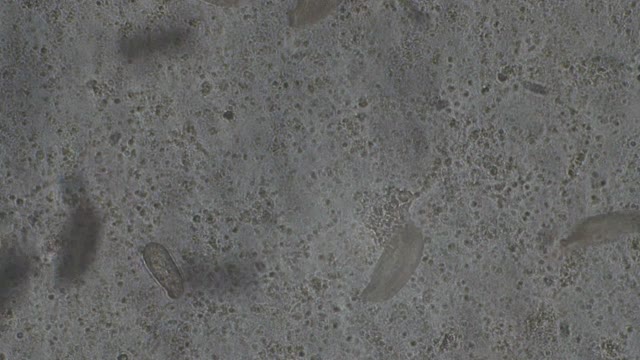 Ciliated Protozoa: Colpidium colpoda
