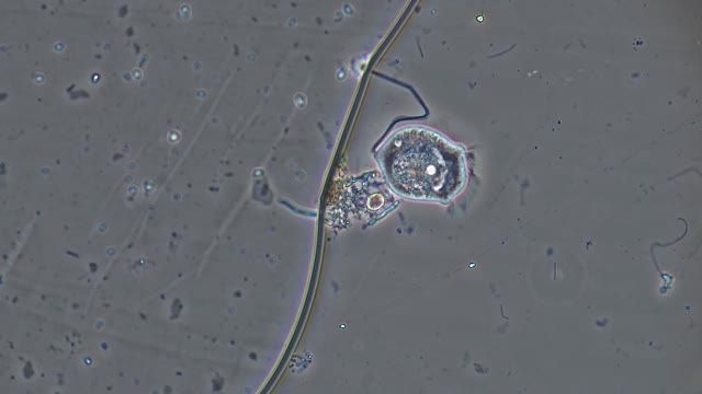 Ciliated Protozoa: Vorticella