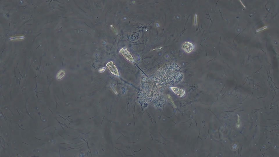 Ciliated Protozoa: Vorticella