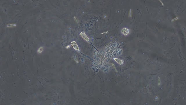 Ciliated Protozoa: Vorticella